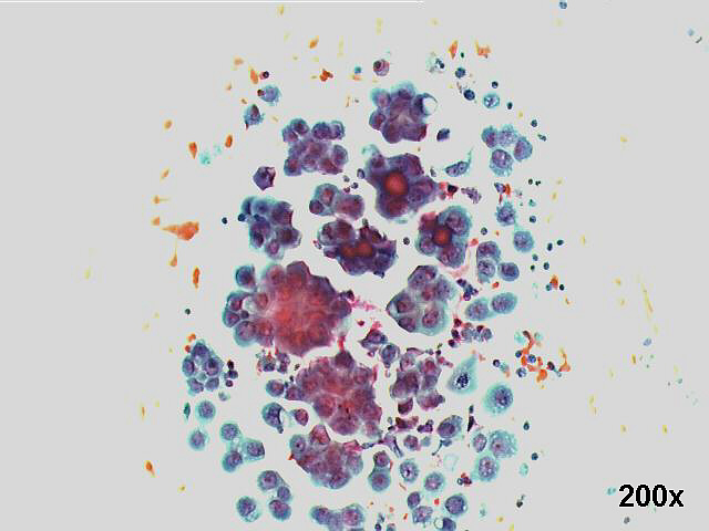 200x Pap staining