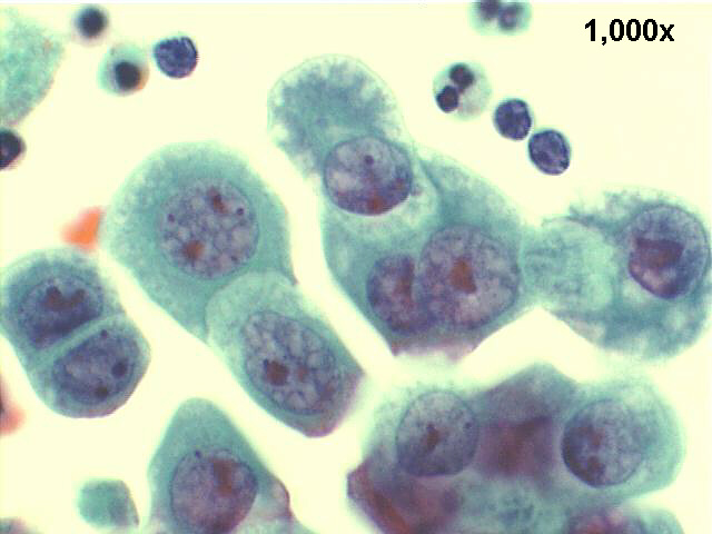 1000x Pap staining