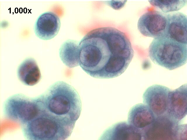 1000x Pap staining