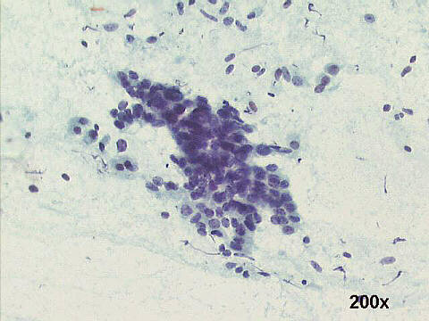 Papanicolaou staining