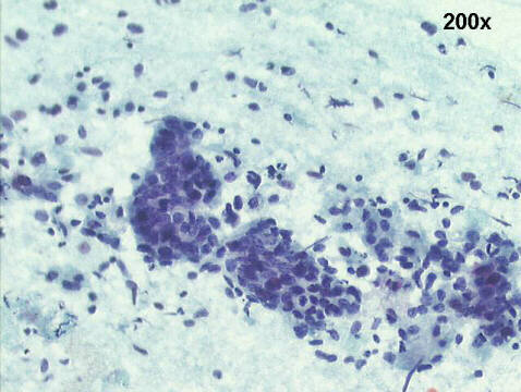 Papanicolaou staining