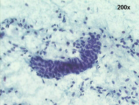 Papanicolaou staining