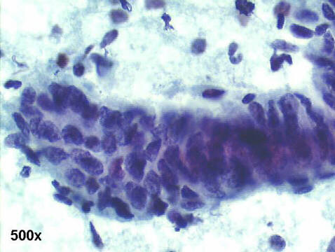 Papanicolaou staining