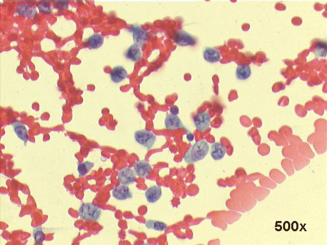 Papanicolaou staining, 500x