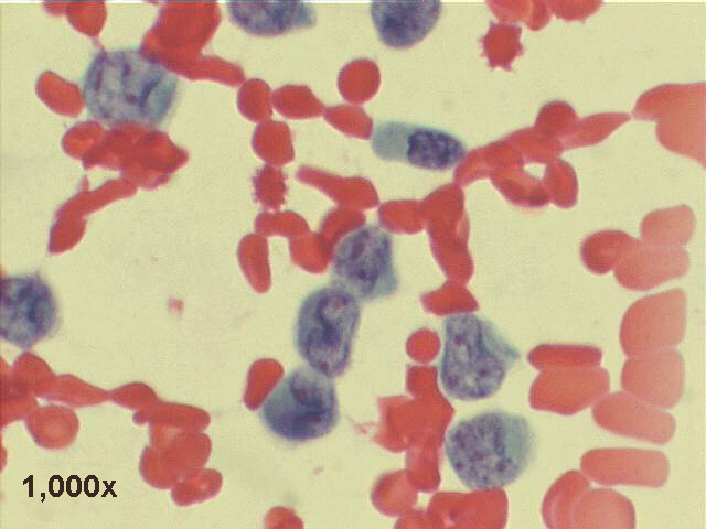 Papanicolaou staining, 1,000x