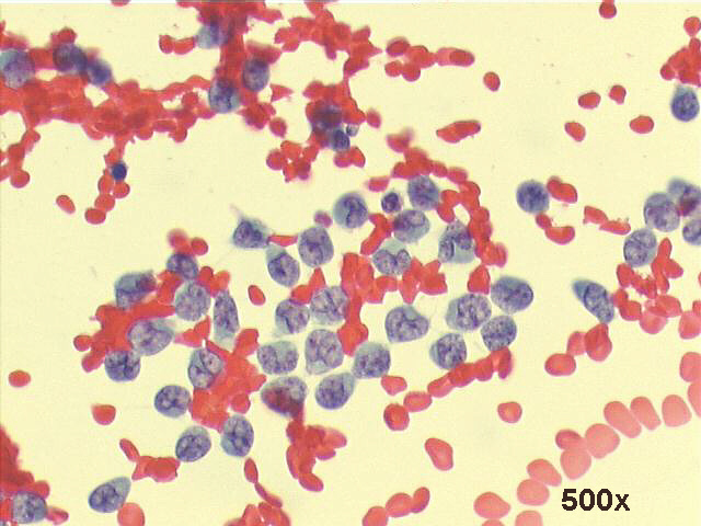 Papanicolaou staining, 500x