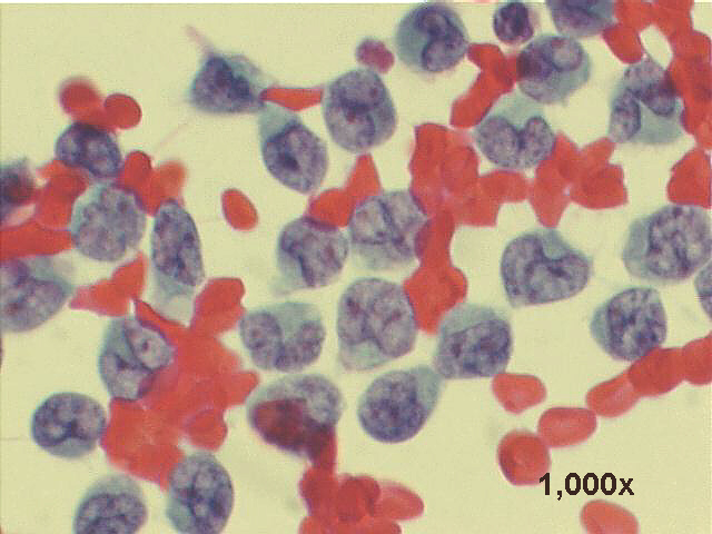Papanicolaou staining, 1,000x