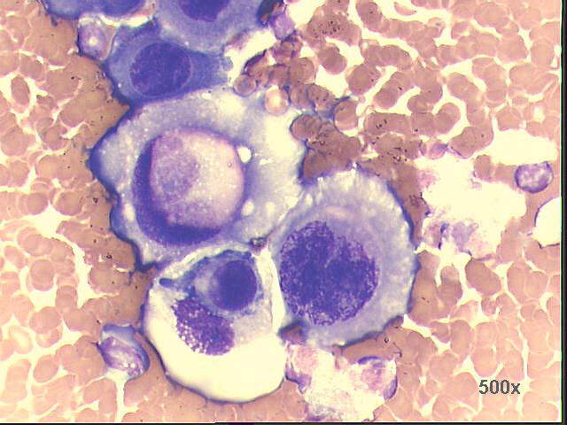 Enlargement of previous picture, 500x M-G-G staining