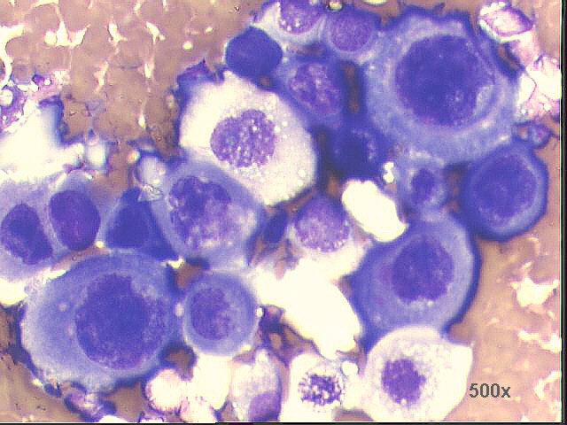 500x M-G-G staining