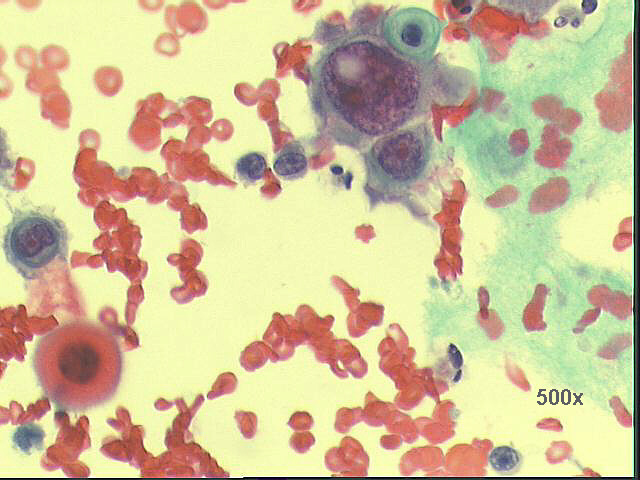 500x Pap staining
