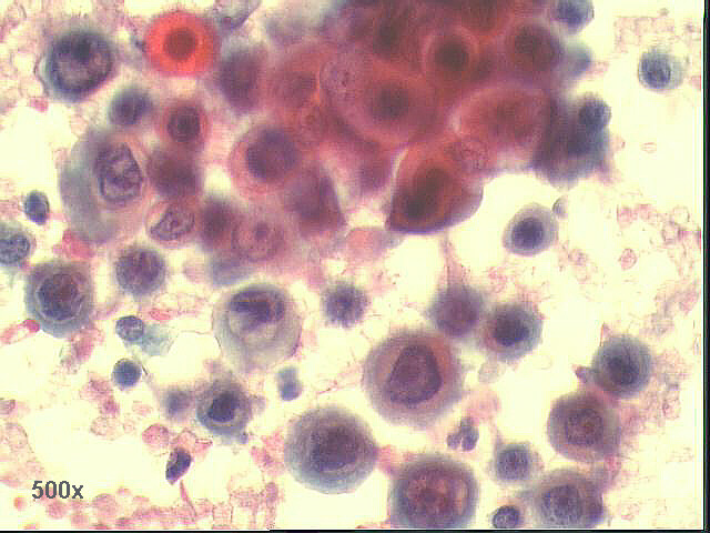 500x Pap staining