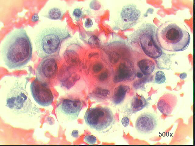 500x Pap staining