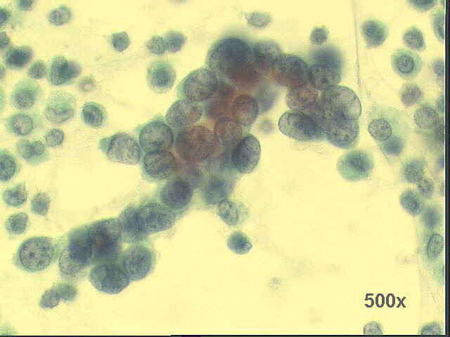 , 500x Pap staining