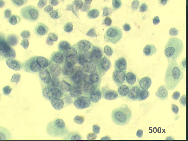 500x Pap staining