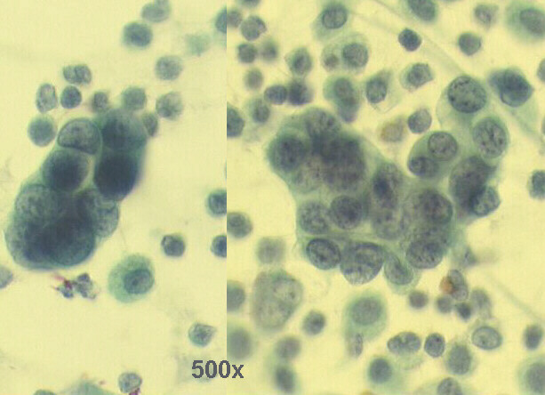 500x Pap staining