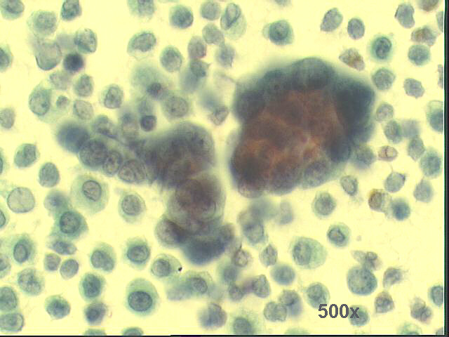 500x Pap staining