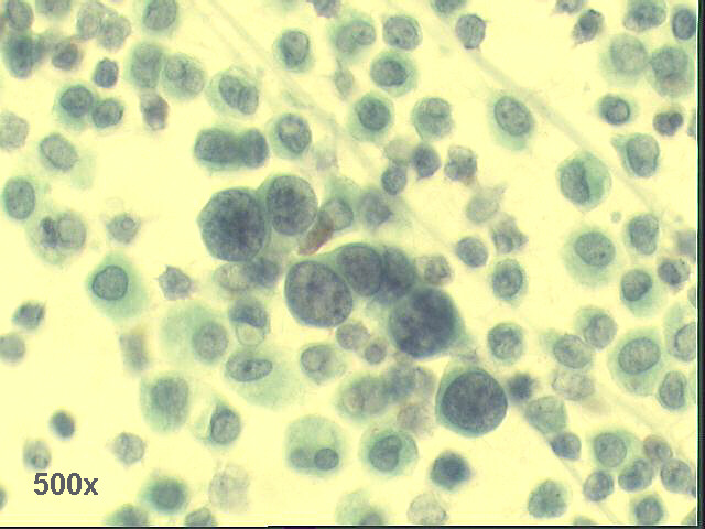 500x Pap staining