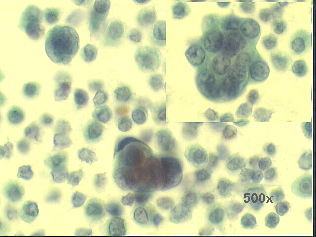500x Pap staining
