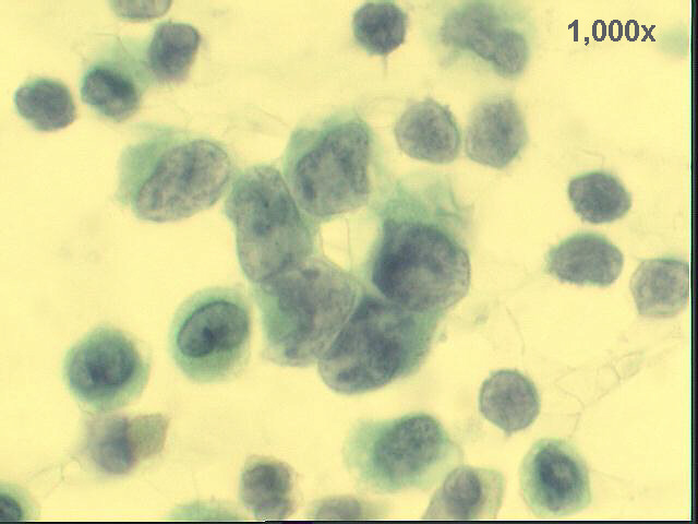 1,000x Pap staining