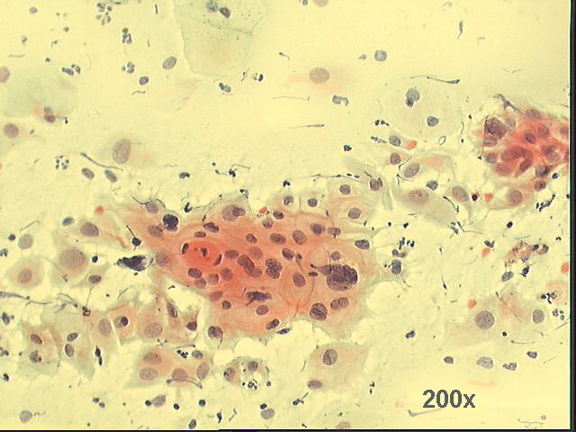 Papanicolaou staining