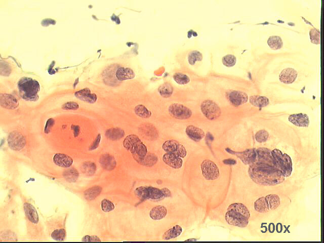 Papanicolaou staining