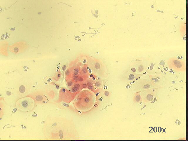 Papanicolaou staining