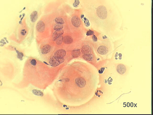 Papanicolaou staining