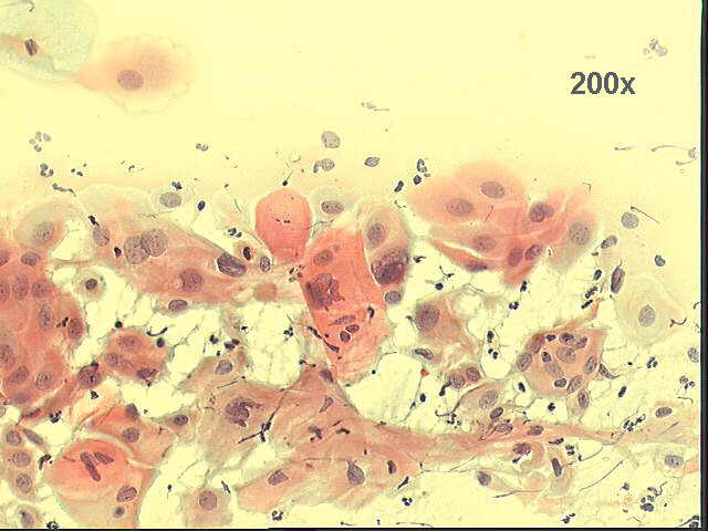 Papanicolaou staining