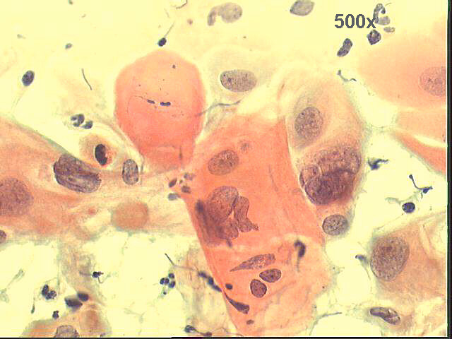 Papanicolaou staining