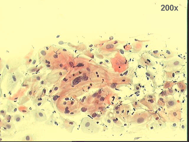 Papanicolaou staining