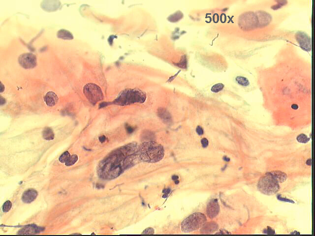 Papanicolaou staining