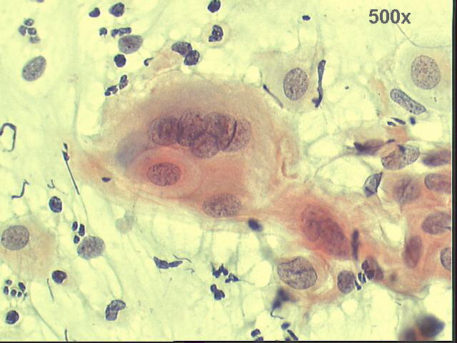 Papanicolaou staining