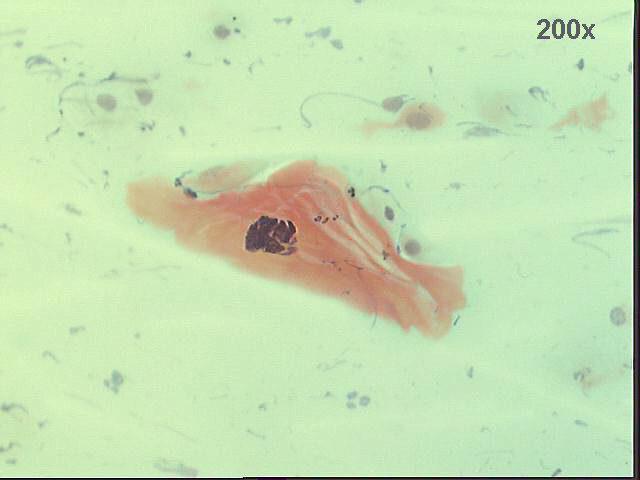 Papanicolaou staining
