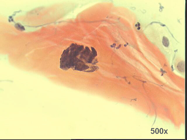 Papanicolaou staining