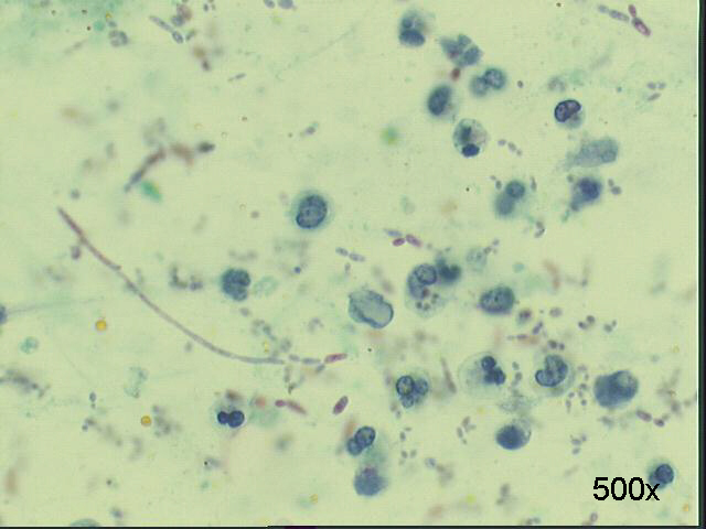 500x Pap staining