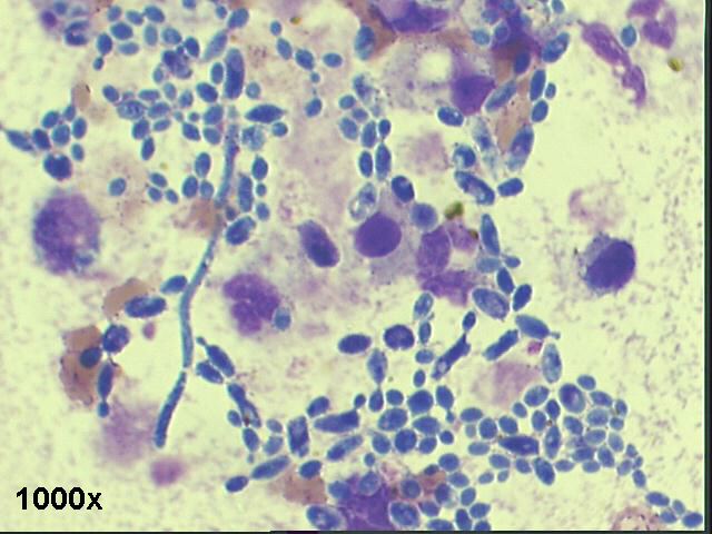 1,000x M-G-G staining