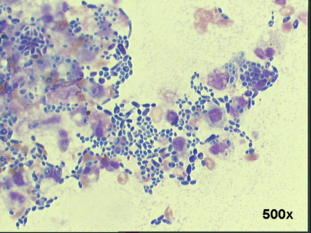 500x M-G-G staining