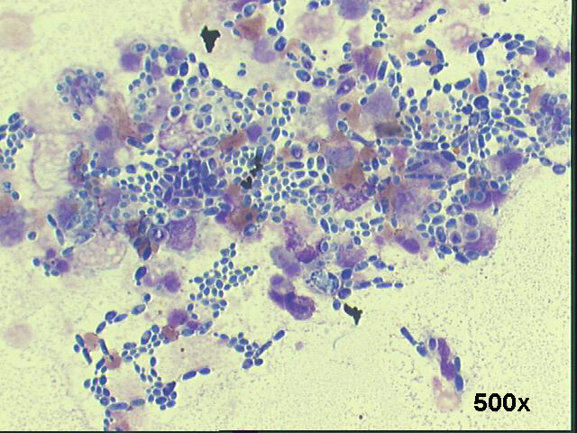 500x M-G-G staining