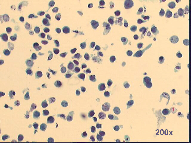 Pap staining 200x