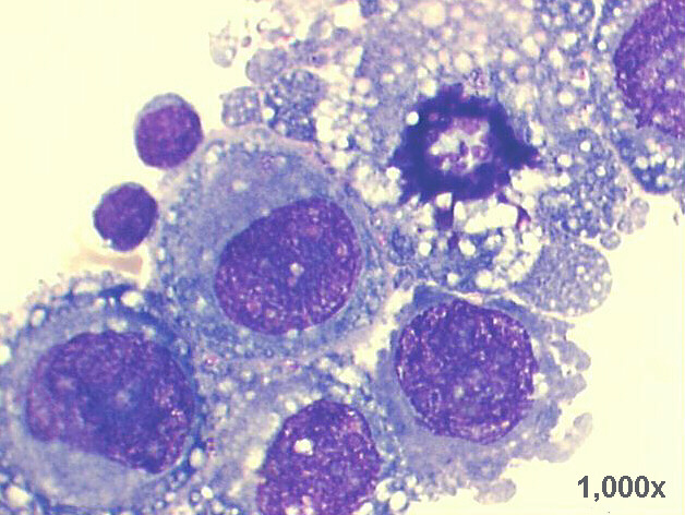 1,000x M-G-G staining, very high power view of previous image