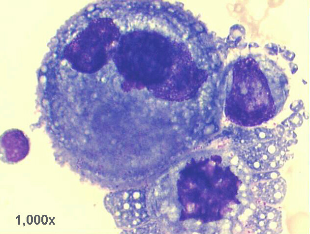 1,000x M-G-G staining, another very high power view