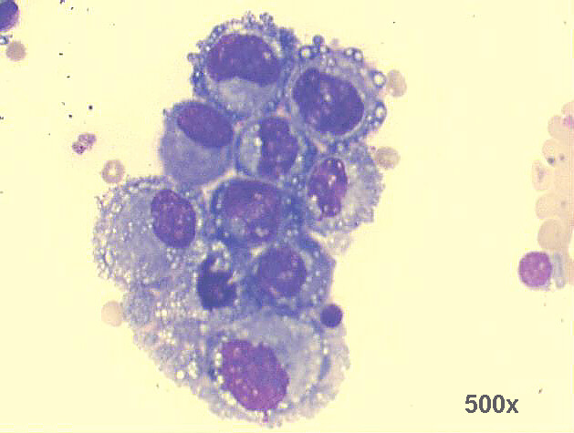 500x M-G-G staining, high power view