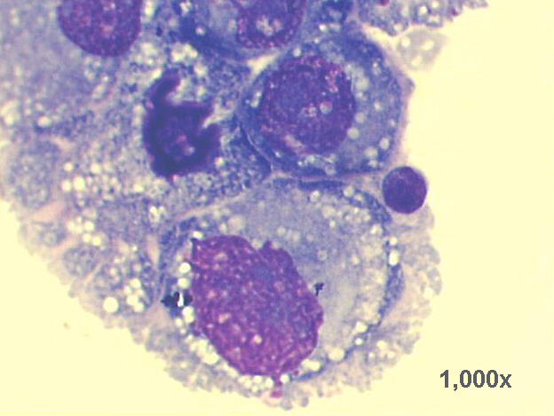 1,000x M-G-G staining, very high power view of previous image