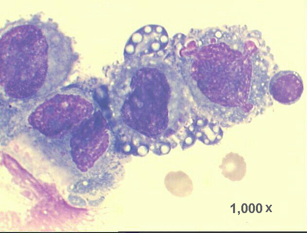 1,000x M-G-G staining, very high power view