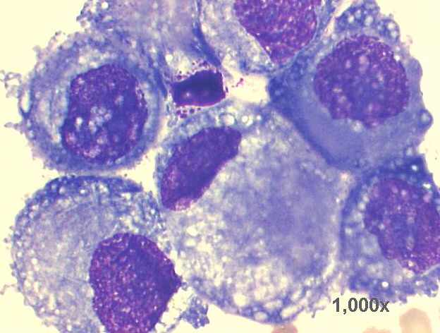 1,000x M-G-G staining, very high power view of previous image