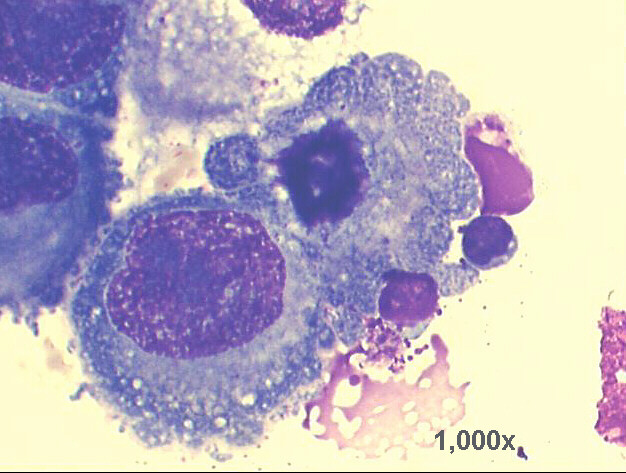1,000x M-G-G staining, very high power view