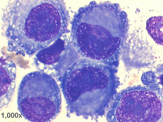 1,000x M-G-G staining, very high power view