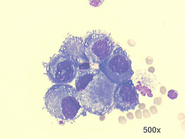 500x M-G-G staining, high power view