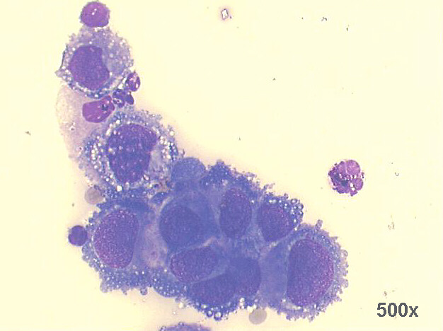 500x M-G-G staining, high power view