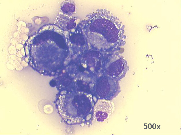 500x M-G-G staining, high power view